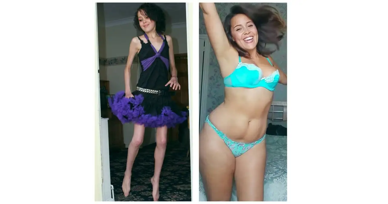 The role of escorts in Milan in promoting body positivity and self-esteem